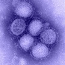 H1N1purple